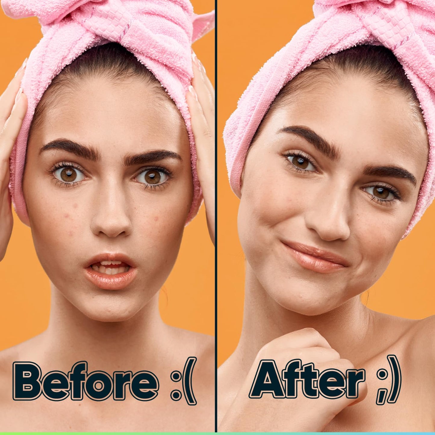 Say goodbye to breakouts! π 216 Tea Tree Oil Pimple Patches for the ultimate acne-fighting power! πͺβ¨ #SkincareEssentials #AcneSolution
