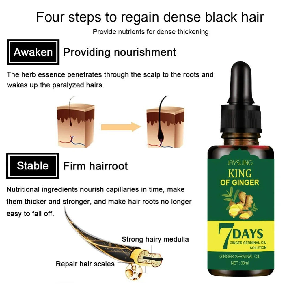 5 PACK Hair Growth Serum, Biotin Hair Growth Oil,Hair Regrowth Treatments for Men and Women,Hair Growth Treatment,Ginger Oil for Hair Growth,Hair Loss Treatment,Promotes Thicker,Stronger Hair